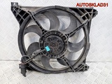 Вентилятор радиатора Hyundai Trajet GPBF00S3A2192 (Изображение 1)